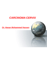 CARCINOMA CERVIX cover