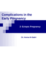 ECTOPIC PREGNANCY cover