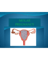 Molar Pregnancy, GTD د.اسماء cover