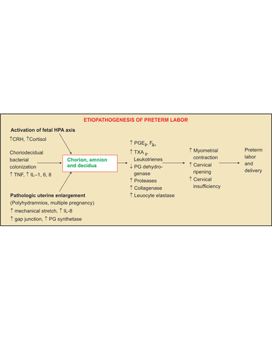PRETERM LABOUR cover