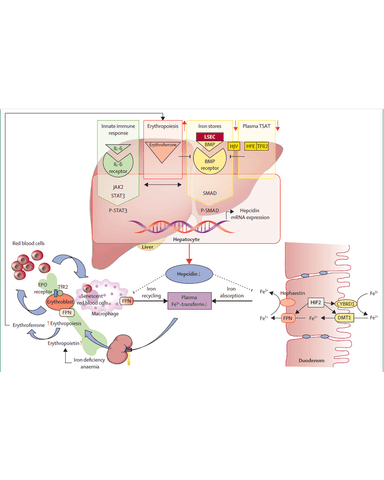 IRON DEFICIENCY ANEMIA AND ANEMIA OF CHRONIC DESEASE cover