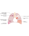 TREATMENT FOR PE cover