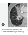 CANDIDIASIS AND HISTOPLASMOSIS cover