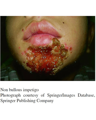 SKIN INFECTIONS cover